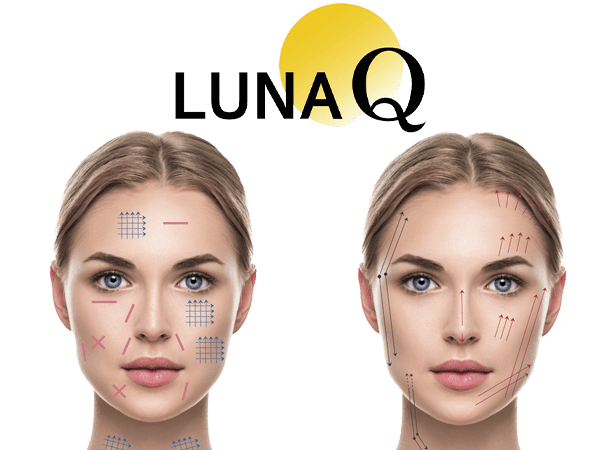 Luna Q Fils tenseurs PLCL