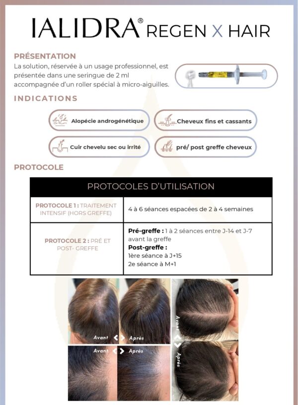 Indications protocoles et resultats avant apres du traitement capillaire IALIDRA Regen X Hair